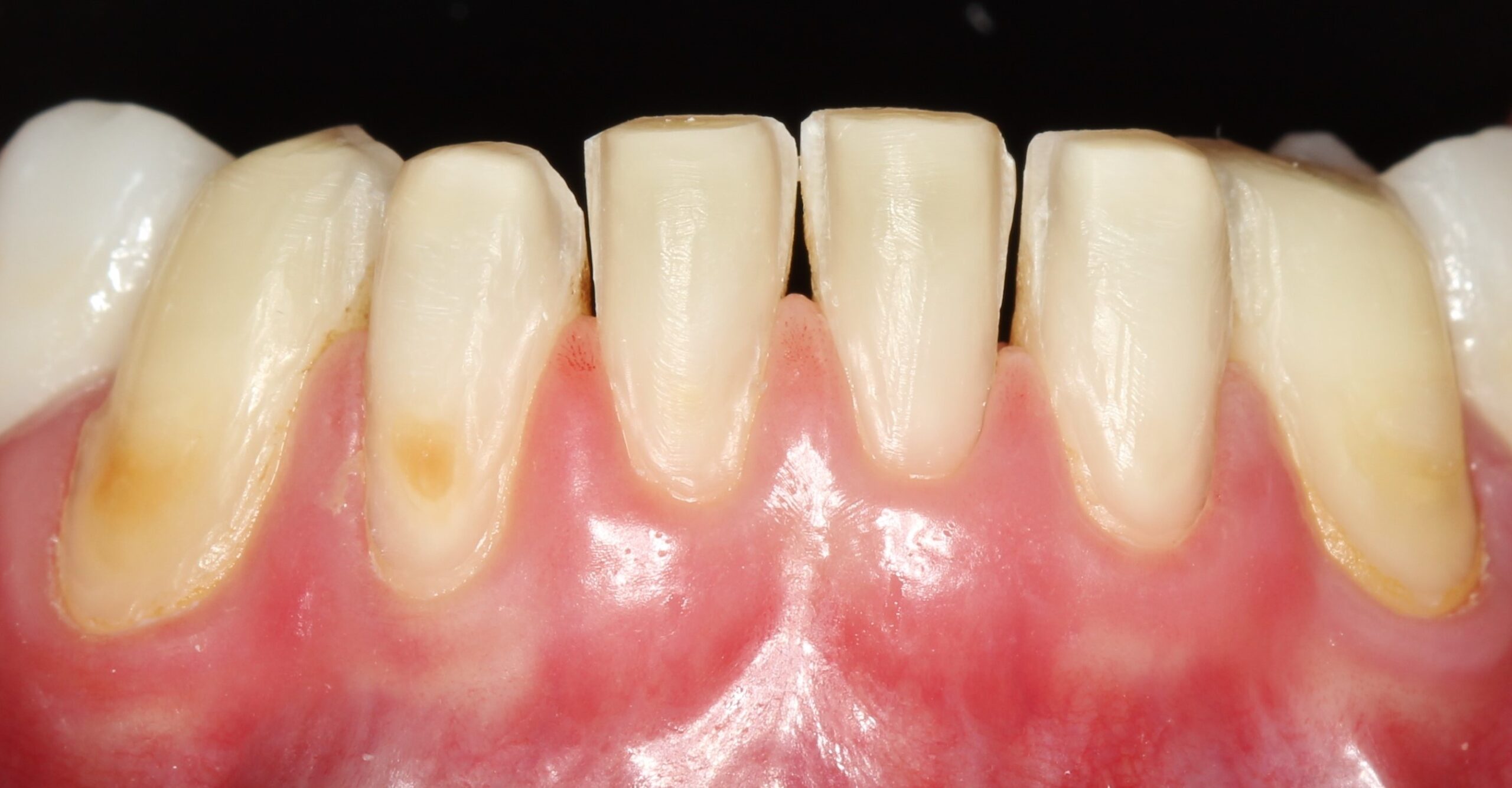 https://mexicoimplantdentistry.com/wp-content/uploads/2022/07/15-scaled.jpg