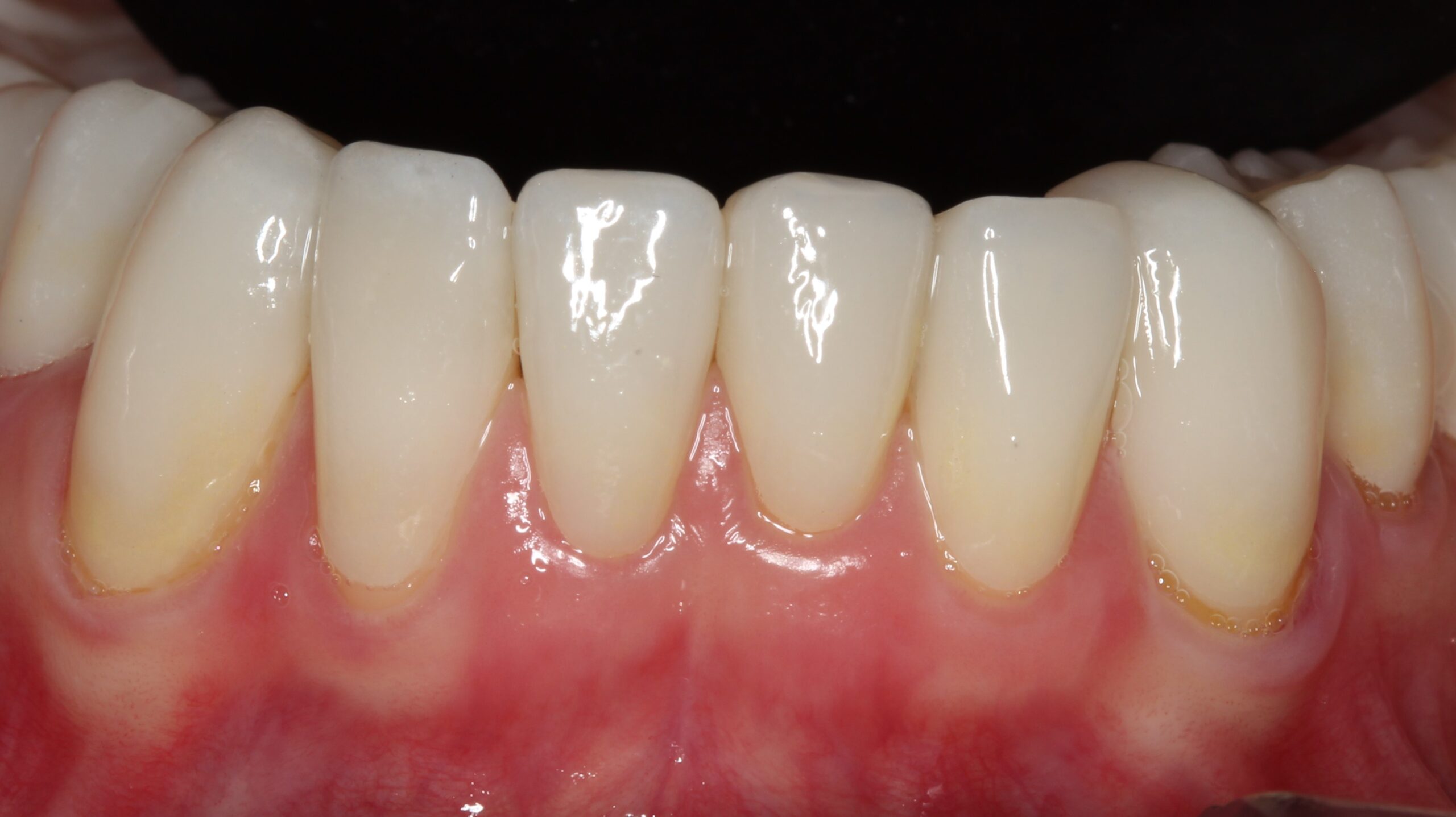 https://mexicoimplantdentistry.com/wp-content/uploads/2022/07/16-scaled.jpg